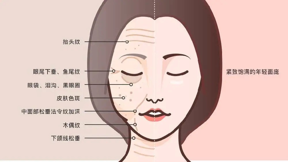 科普 医美知识科普|面部埋线提升——让脸型变得好看