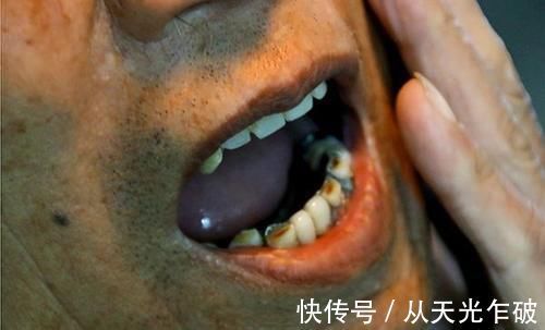 身体|常吃核桃,好处比较多,医生却说:3种人吃了对身体并不好