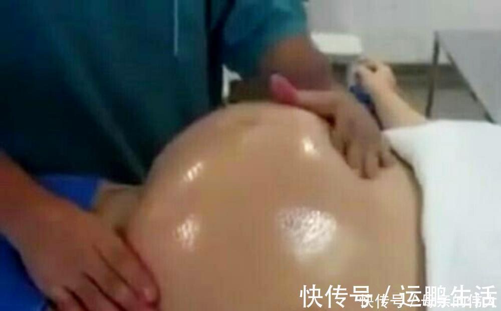 产妇|怀孕后多久,胎位就要固定了?这个孕周前,孕妈还能“调乾坤”