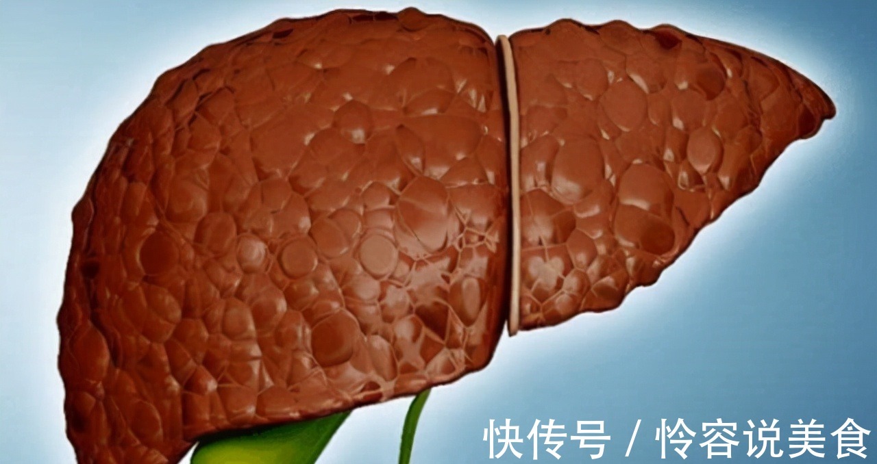 冠状动脉|多走路能降血脂医生提醒日常多吃这4物,或比走路效果好