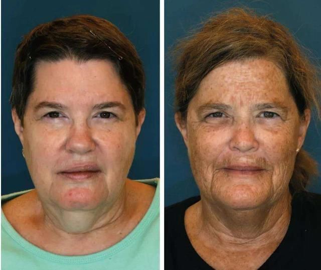 衰老|加速男人衰老的“祸根”,烟酒只排第5,第1名很难避开