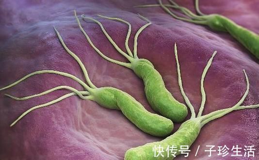 幽门螺杆菌|有种水是“杀菌水”,灭掉幽门螺杆菌,胃酸、胃疼不敢扰!