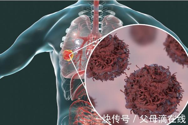 心脏病|硒是预防心脏病、抵抗癌症的必需元素，吃哪些食物能补充？