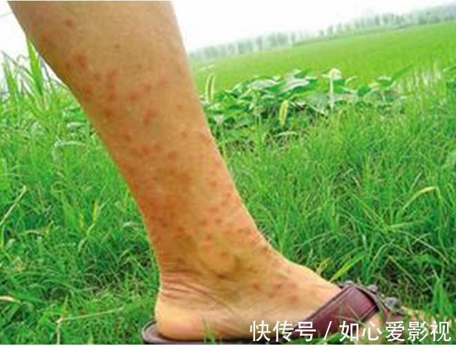 患处|治疗皮肤病的经典秘方！看看有您需要的吗？太难找，好好收藏！