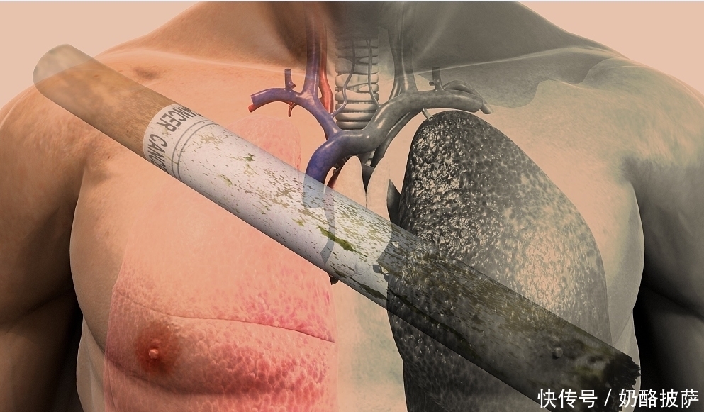 身体|肺好不好,看身体5个表现!远离三烟,多吃三白,肺会慢慢变好