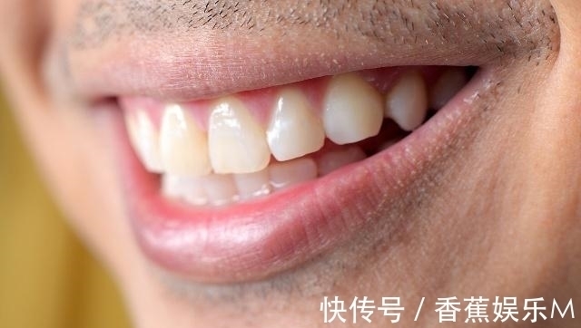 衰老|男性步入“衰老期”,脸部会有5个变化,一个不占,说明你还年轻