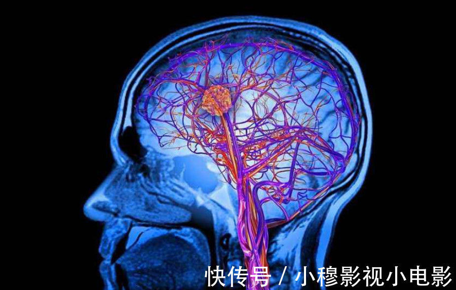 食物|终于发现脑梗“内幕”！医生：大脑最怕3样食物，现在了解还不迟