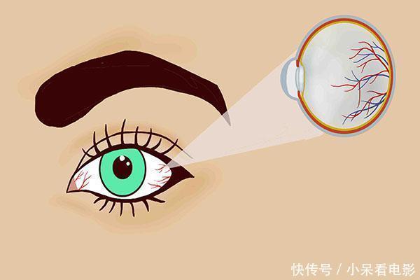 异常|血脂高不高,看看脸就知,脸上出现哪些异常,提醒你要降血脂?