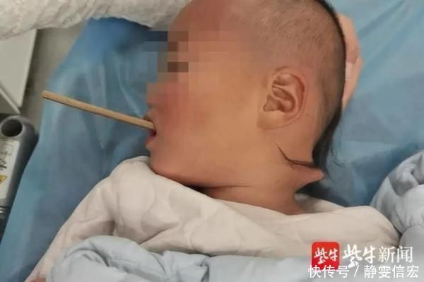 林林|一根筷子把2岁多孩子的脖子戳穿!这些物品家有宝宝的要格外小心