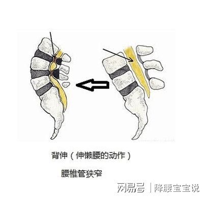 回事|间隙性跛行怎么回事？背后隐藏12种病，看看你是哪种？