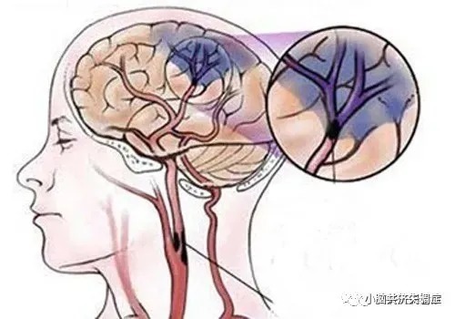 缓解|补充维生素可以缓解小脑萎缩疾病吗