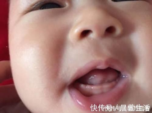 yoyo|婴幼儿什么时候长牙？这5个“信号”告诉妈妈：我长牙了