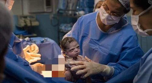 小动作|我就是不哭!”剖腹产宝宝“眼神杀”太霸气,网友:是个狠人