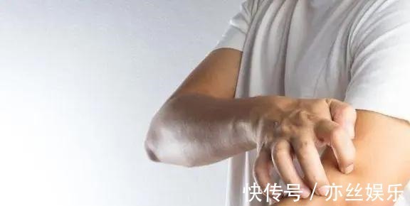 皮肤过敏|身体2处“发痒”,别误以为是过敏了,或是肝脏癌变发出的求救信