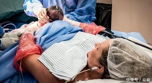 硬膜外麻醉|奇闻：女子觉得孩子出生第一个抱的人很重要，手术台上，自己接生