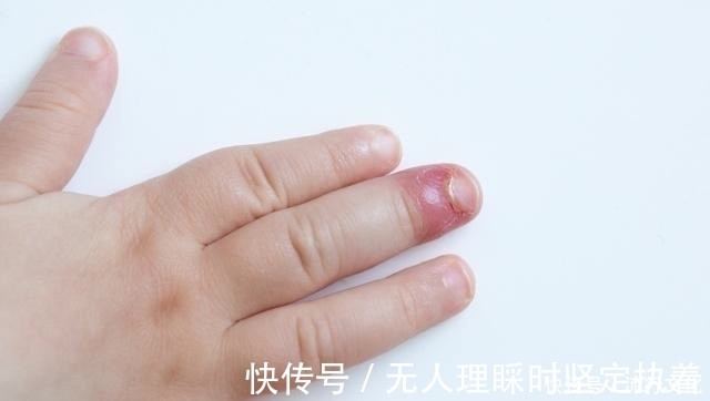 视力|血糖高的人,脸上若没有这4个“变化”, 恭喜你!状态可能还不错