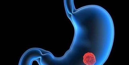 按摩|养胃4步骤，只要你坚持，不愁肠胃不健康！