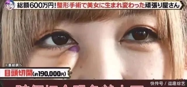 亲妈|亲妈鼓励整容,日本妹子十年花600万“变脸”,颜值不输动漫偶像