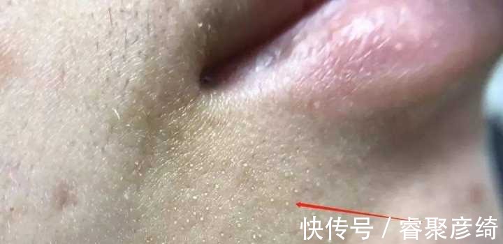 洗脸|为什么我的爽肤水不好用？