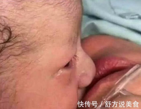 婴儿|产妇难产大出血,才出生的婴儿流泪亲吻妈妈嘴唇,所有医生都哭了