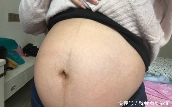 胎儿|怀孕后孕妇从这周开始显怀,如果肚脐没有这种表现,说明很有福气