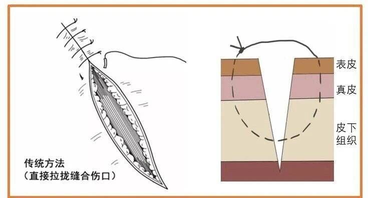 八大处 外伤缝合不想“留疤”？成都有了24小时“美容缝合急诊”！