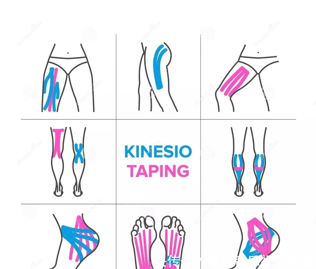 图片|一分钟学会使用肌效贴(图片+视频教程)