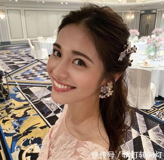 发量|“ 大肠发圈 ”烂大街了!这些发饰才是真洋气!