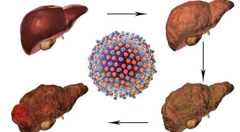 肝脏类|黑米熬粥可养肝?医生:无知!真想养肝,2种“谷物”要少吃