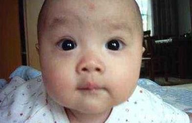 宝爸|宝妈生下7斤男宝,儿子“没眼睛”急坏小两口,医生检查后笑出声