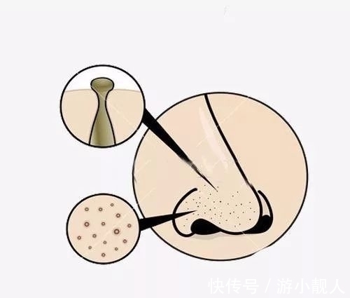 毛孔 小心!以下5个护肤坏习惯,能让你的毛孔越来越大……