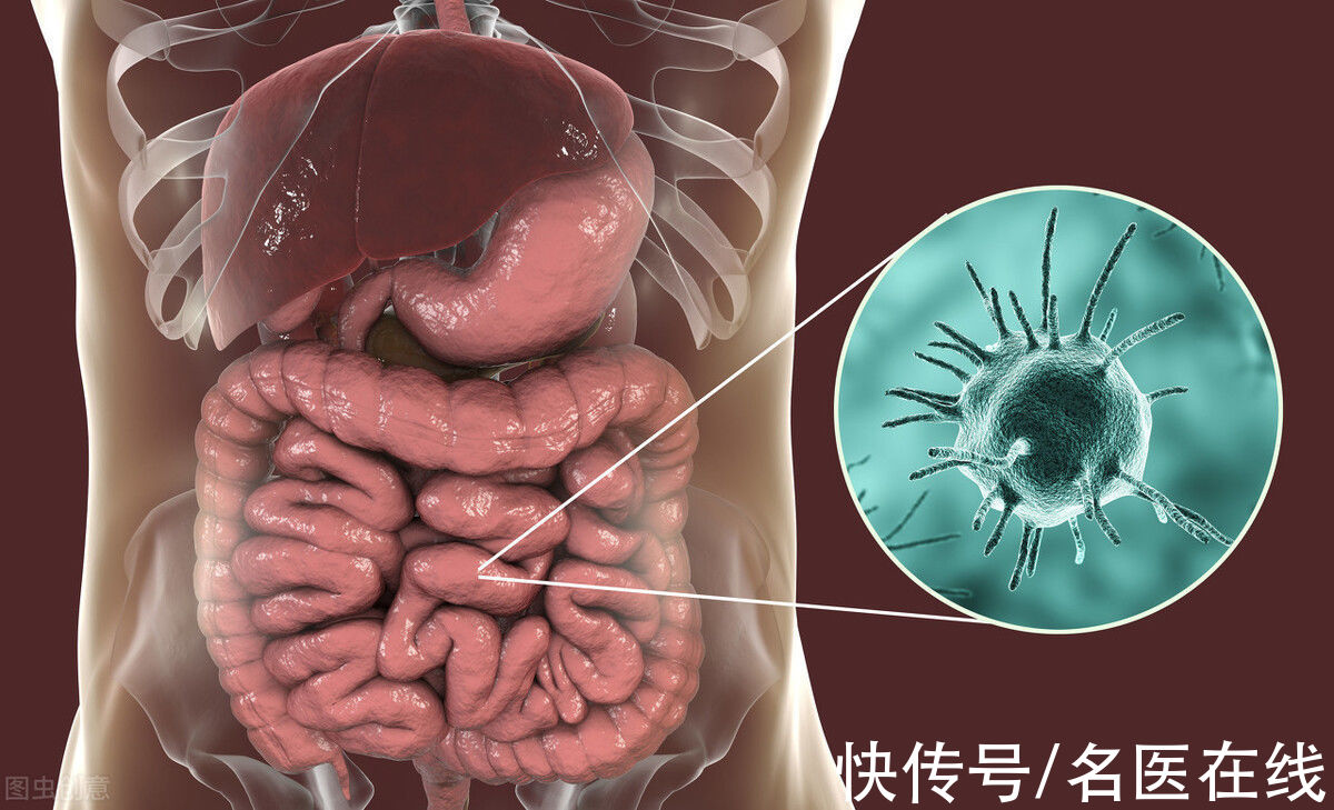 肠癌|大肠癌上门，身体会发出5种警示！这7类高风险人群要提前注意