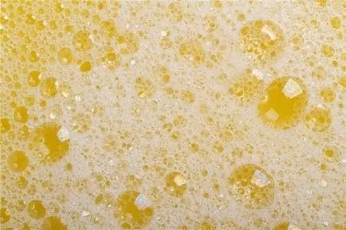 小便|尿中有一层泡沫,是得肾病了?小便泡沫多,可能还暗示这些问题