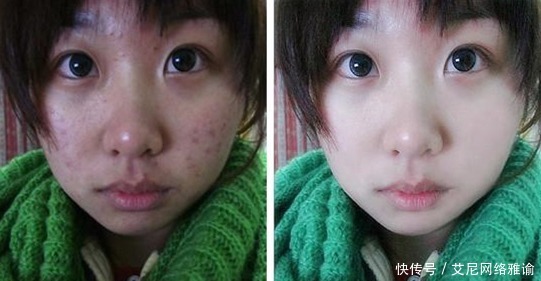 皮肤科医生提醒:这几款火爆全网的护肤品,含有刺激性激素