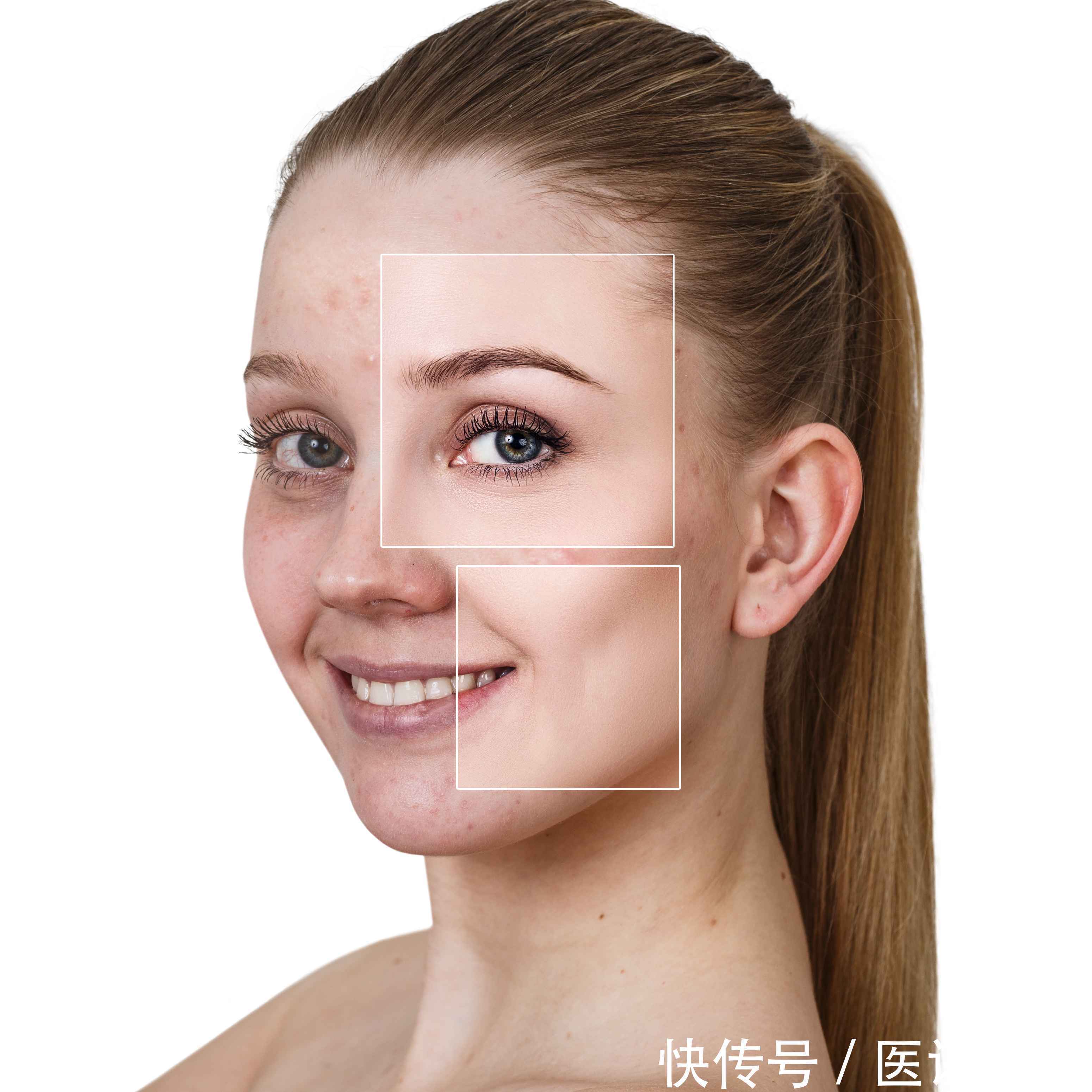 手脚冰凉|女人气血不足时,身体或有这6个表现,若你都符合,要及时调理