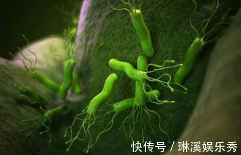 碳酸饮料|消化科医生:2招可“剿灭”幽门螺杆菌,可惜很多人坚持不下来