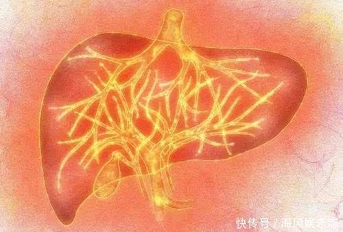 胃火|胃火、心火、肝火、肺火，人体这“4把火”怎么除1道食疗1把火
