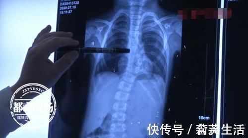 妈妈|妈妈给5岁儿子洗澡,发现他后背竟是歪的,医生痛批孩子这种习惯