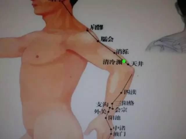  头痛辩证取穴