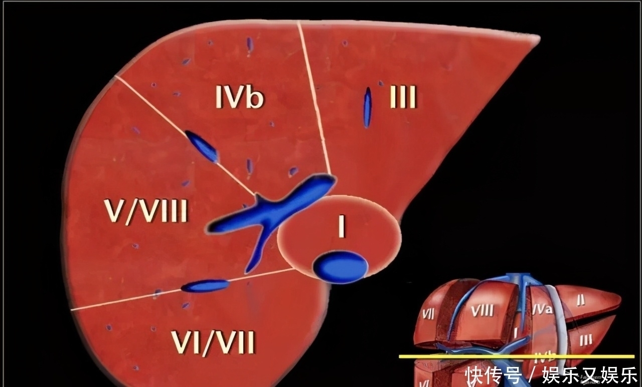 非游离脂肪酸|血脂高有什么症状,以及降血脂的“六字真言”是什么?