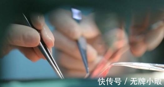 移植|狒狒心脏可以代替人类心脏吗?加州这个女孩,移植心脏后活了21天