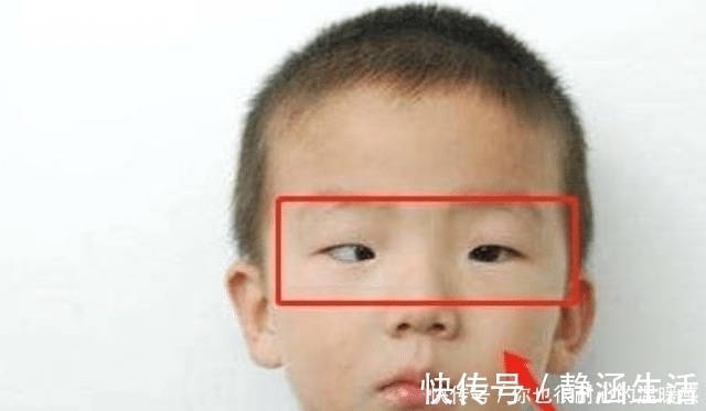 小王|越来越多孩子黑眼珠“消失”,与这种“玩具”脱不了干系,需警惕