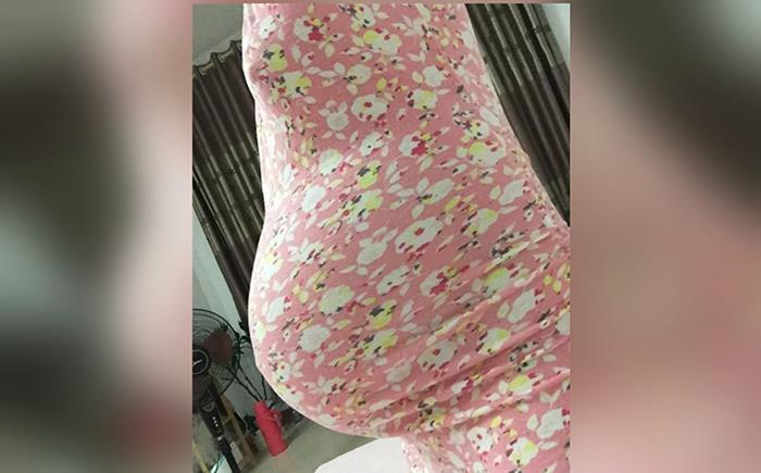 生双胞胎|“生剖”是什么体验？抗麻体质剖腹产生双胞胎，痛得直哆嗦