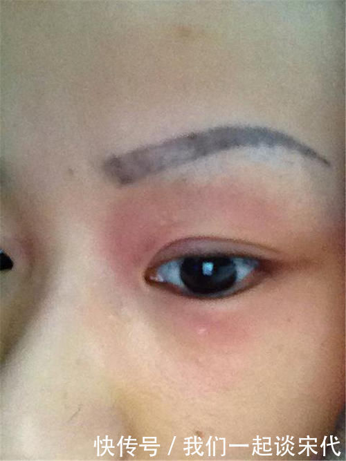 医生|4岁女儿误将胶水滴入眼睛,宝妈临危不乱的做法,医生直夸有文化