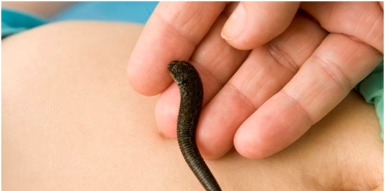 水蛭|农村老人说把蚂蝗烧成灰,把灰放在水里,就能长出小蚂蟥,真的吗