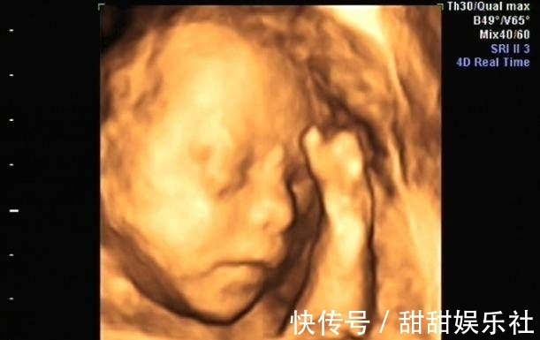 性别|为什么有些医院做四维彩超不让家属陪同这些原因,大家有权知道