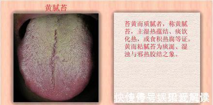 脾胃|儿科主任:夏季孩子脾虚积食多,少吃“2红”,多吃“2黄”