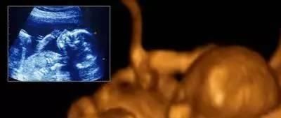 宝宝|一组图记录怀胎十月,胎儿发育全过程,看完后,感叹生命神奇