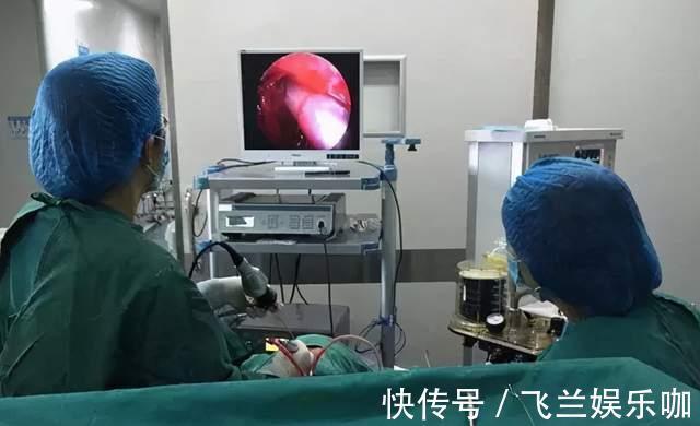 孩子|四岁宝宝被鱼刺卡喉咙，母亲用这个方法取出刺，大夫连连夸赞