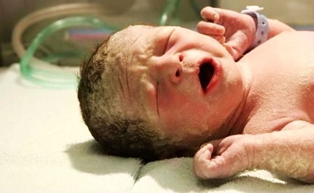 脐带|剪脐带时,是孩子疼还是妈妈疼?答案有些意外